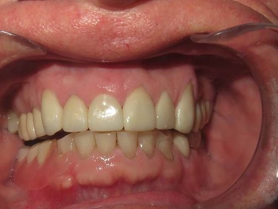 Smile Makeover Case 2 - After