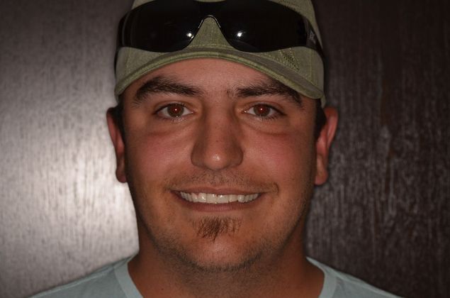 Dental Implants: Case 35 - After