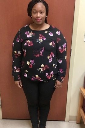 Patient Transformation Stories: Kamillea Lost 75 Pounds in 6 Month During Quarantine! - Before