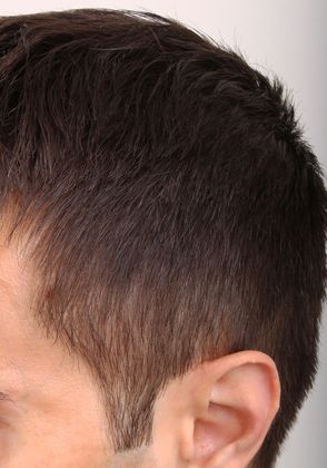 Hair Loss Treatments for Men and Women | Omniya London