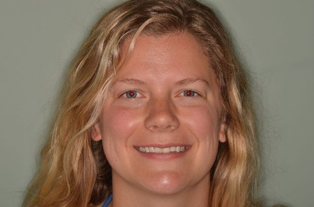 Dental Implants Case 36 - Before