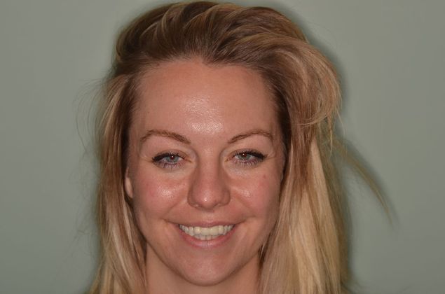 Bridges: Case 5 - Before