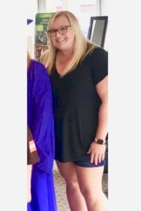 Patient Transformation Stories: Melissa Lost 80 Pounds and Wears Her Daughter