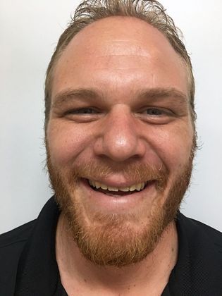 Veneers and Crowns: Case 1 - Before