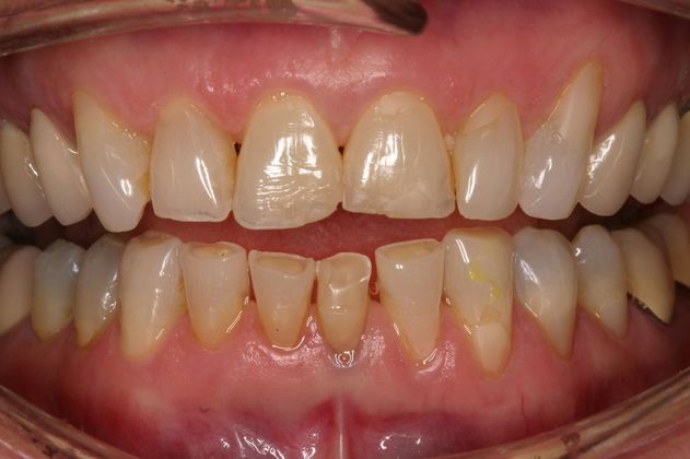 Orthodontics Pat - Before