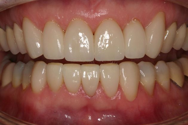 Orthodontics Pat - After