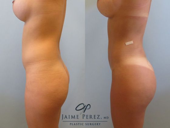 Before & After