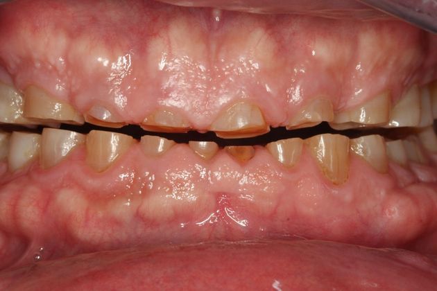 Cosmetic Dentistry: Cosmetic Dentistry - Case 3 - Before