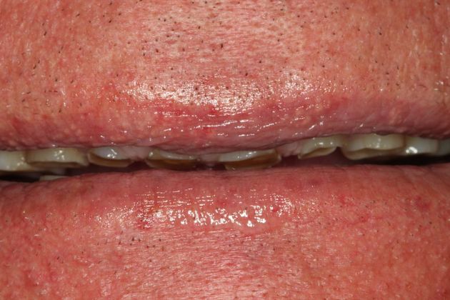 Cosmetic Dentistry Cosmetic Dentistry - Case 3 - Before