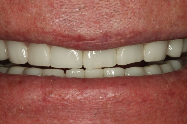 Cosmetic Dentistry Cosmetic Dentistry - Case 3 - After