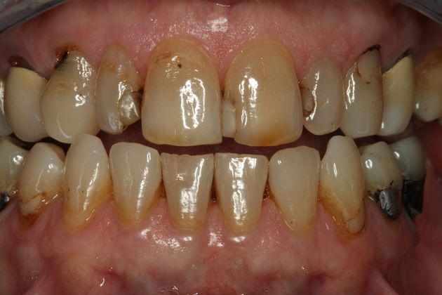 Cosmetic Dentistry Cosmetic Dentistry - Case 4 - Before