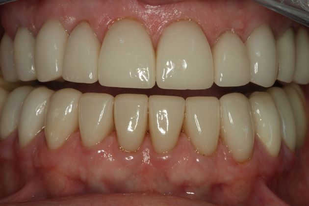 Cosmetic Dentistry Cosmetic Dentistry - Case 4 - After