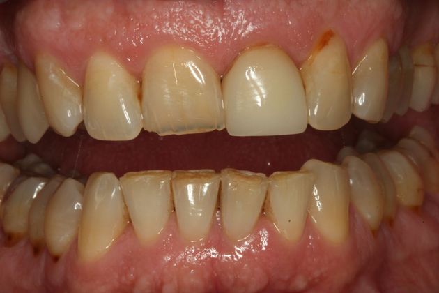 Cosmetic Dentistry Cosmetic Dentistry - Case 5 - Before
