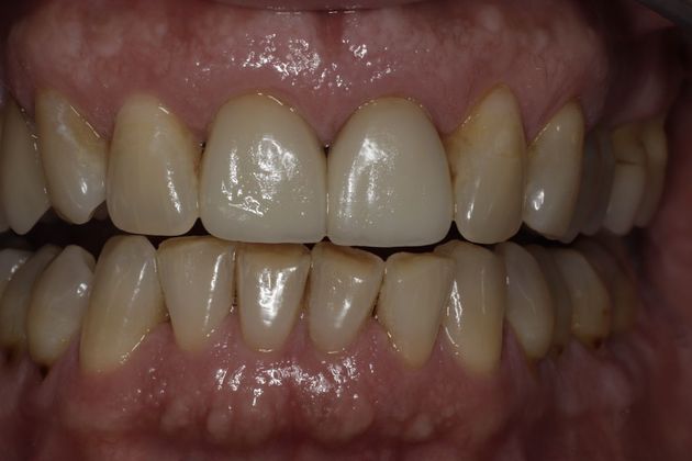 Cosmetic Dentistry Cosmetic Dentistry - Case 5 - After