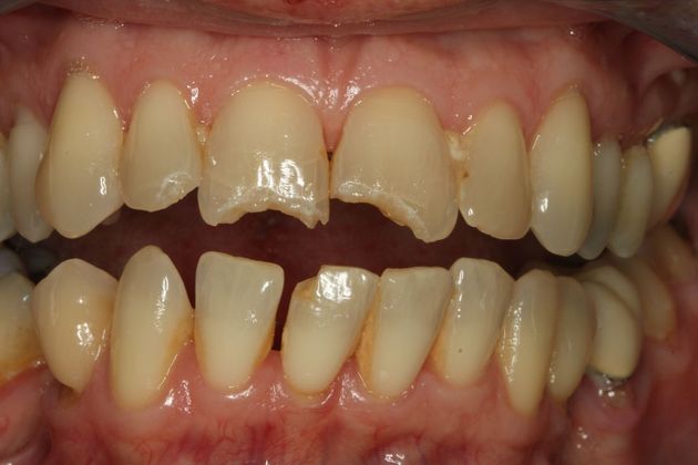 Cosmetic Dentistry Cosmetic Dentistry - Case 7 - Before