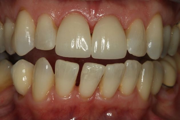 Cosmetic Dentistry Cosmetic Dentistry - Case 7 - After