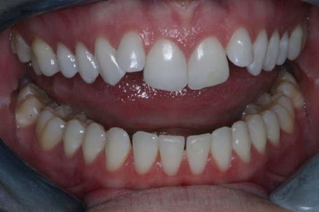 Cosmetic Dentistry Case 2 - Before
