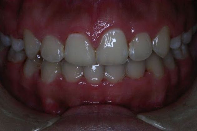 Orthodontics Case 2 - After