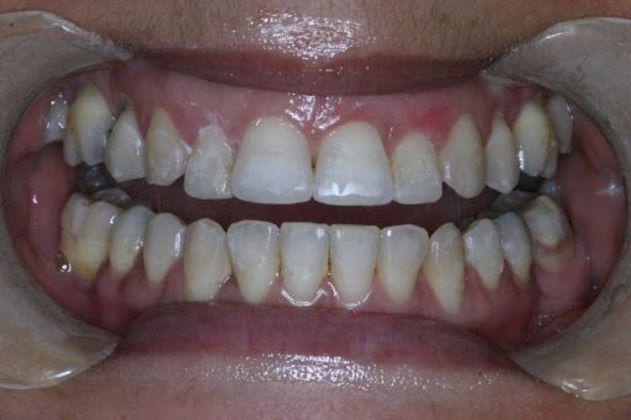 Orthodontics Case 5 - After