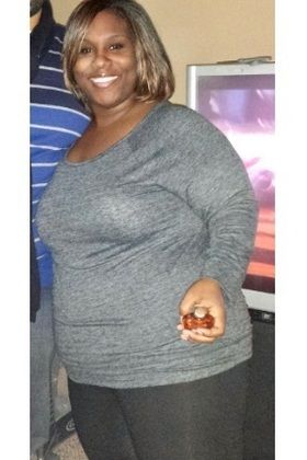 Patient Transformation Stories: Kawona Has Kept 170 Pounds off Since 2009! - Before