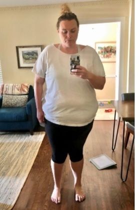 Patient Transformation Stories: Knee Surgery & a Pandemic Did Not Stop Mary! - Before