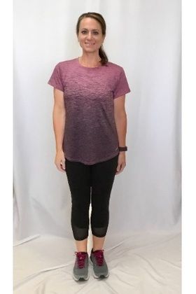 Patient Transformation Stories: Ashley Lost 125 Pounds with a Revision! - After