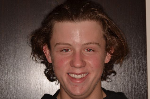 Invisalign: Case 13 - After invisalign