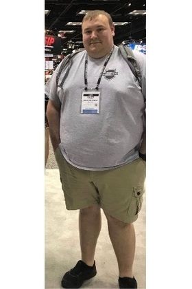  Patient Transformation Stories Kaleb Lost 126 Pounds in 6 Months! - Before