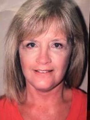 Facelift Case 4 - After