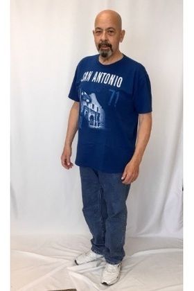 Patient Transformation Stories: Marine Corp Vet Hector