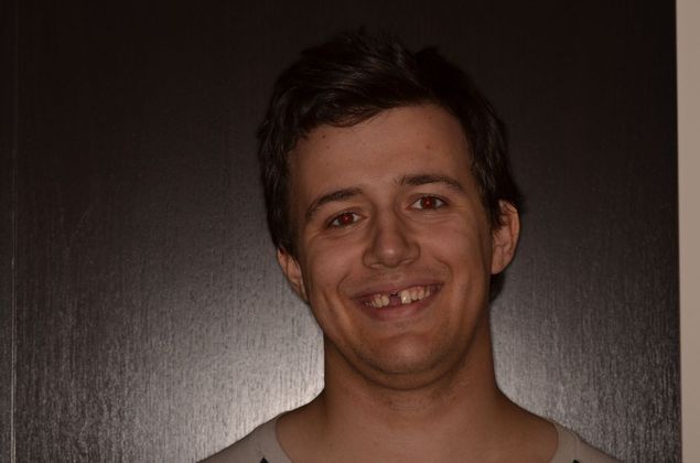 Dental Implants: Case 41 - Before implant crown placement