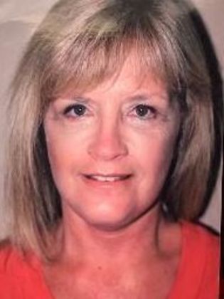 Face & Neck Lifts Case 2 - After