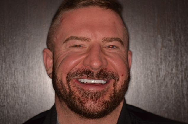 Smile Design: Case 8 - After Porcelain veneers