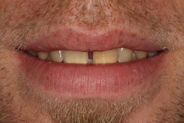 Smile Design: Case 9 - Before smile