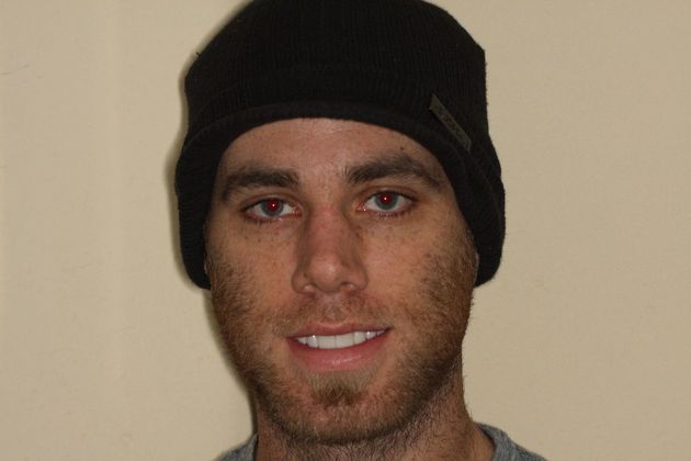 Smile Design: Case 9 - After Porcelain veneers