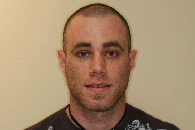 Diastema closure: Case 1 - Before Diastema closure