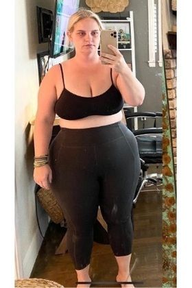 Patient Transformation Stories: WLS Saved Jordan