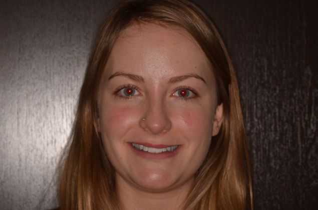 Porcelain Veneers: Case 22 - After Porcelain veneers