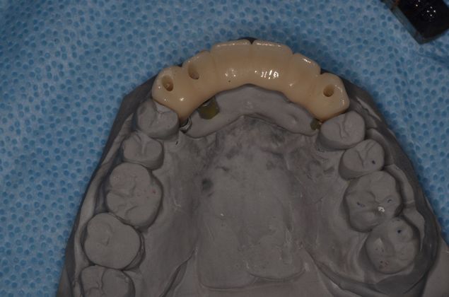 Bridges: Case 8 - bridge on model in lab