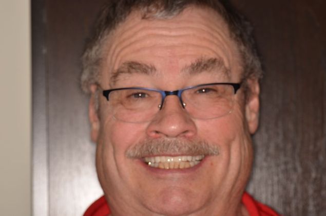 Bridges: Case 8 - After smile