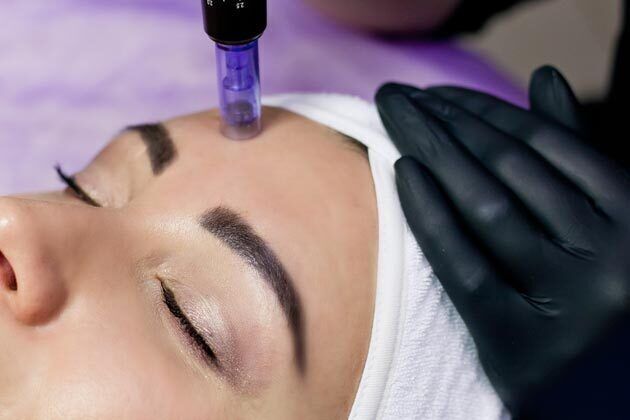 Potenza RF Microneedling Cases