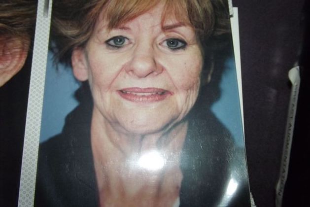 Facelift: Case 1 - Before