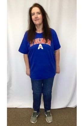  Patient Transformation Stories Debbie