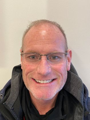 Full Mouth Reconstruction  Case 1 - After