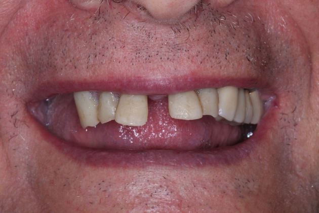 Dr. John Fatse: Case 5 - Before