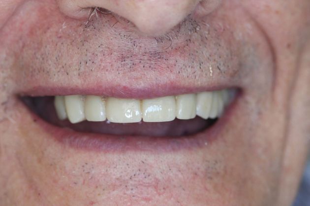 Dr. John Fatse: Case 5 - After