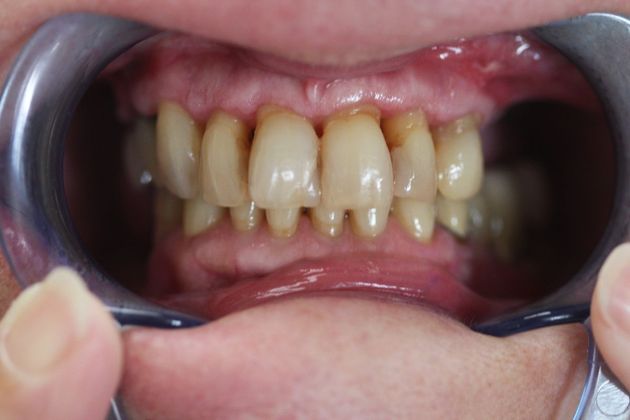 Dr. John Fatse Case 6 - Before