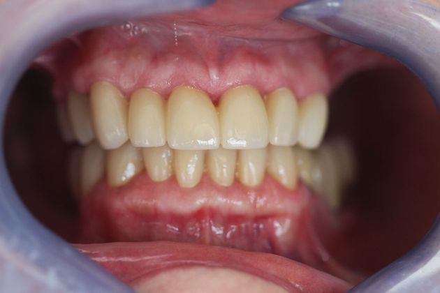 Dr. John Fatse Case 6 - After