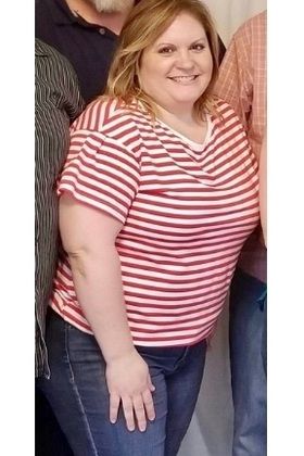  Patient Transformation Stories Maria is Confident Again! - Before