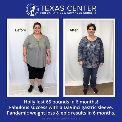 Gastric Sleeve success story [Sarah lost 160 lbs!] Advanced Bariatrics